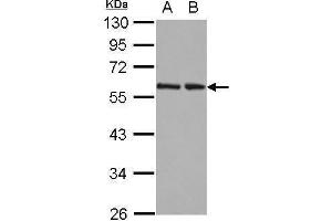 WB Image Sample (30 ug of whole cell lysate) A: 293T B: A431 12% SDS PAGE antibody diluted at 1:10000 (RAD23B anticorps  (Center))