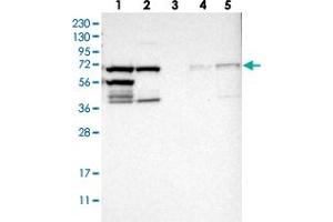 Western blot analysis of Lane 1: RT-4, Lane 2: U-251 MG, Lane 3: Human Plasma, Lane 4: Liver, Lane 5: Tonsil with TRIP4 polyclonal antibody . (TRIP4 anticorps)