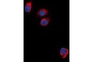 Immunofluorescent analysis of EPO Receptor staining in NIH3T3 cells. (EPOR anticorps)