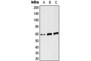 Western blot analysis of Angiopoietin-2 expression in Hela (A), Raw264. (Angiopoietin 2 anticorps  (Center))