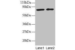 Western blot All lanes: BLOC1S1 antibody at 2 μg/mL Lane 1: EC109 whole cell lysate Lane 2: 293T whole cell lysate Secondary Goat polyclonal to rabbit IgG at 1/15000 dilution Predicted band size: 18, 15 kDa Observed band size: 75 kDa (BLOC1S1 anticorps  (AA 1-153))