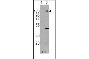 Image no. 1 for anti-Platelet Derived Growth Factor Receptor alpha (PDGFRA) (Tyr720) antibody (ABIN359908) (PDGFRA anticorps  (Tyr720))