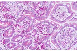 Image no. 2 for anti-KTI12 Homolog, Chromatin Associated (KTI12) (AA 170-219) antibody (ABIN6749797)