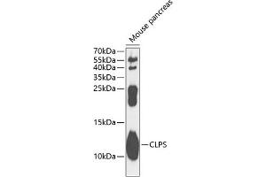 Western blot analysis of extracts of mouse pancreas, using CLPS antibody  at 1:1000 dilution. (CLPS anticorps  (AA 18-112))
