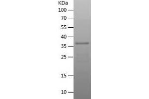 Western Blotting (WB) image for Thioredoxin-Related Transmembrane Protein 3 (TMX3) (AA 40-187) protein (His-IF2DI Tag) (ABIN7125369)