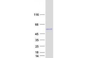 Validation with Western Blot