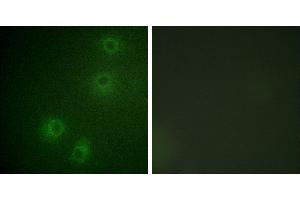 P-peptide - +Immunofluorescence analysis of COS-7 cells, using Integrin β1 (Phospho-Tyr789) antibody. (ITGB1 anticorps  (pThr789))