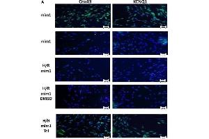 Telmisartan effects on hypoxic H9c2 cardiomyocytes transfected with miR-1 mimic. (KCNQ1 anticorps  (AA 501-600))
