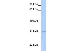 WB Suggested Anti-MARCH2 Antibody Titration:  0. (MARCH2 anticorps  (Middle Region))
