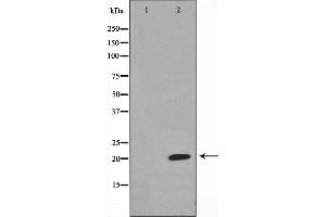 Western blot analysis on Jurkat cell lysate using Musculin Antibody,The lane on the left is treated with the antigen-specific peptide. (Musculin anticorps  (Internal Region))
