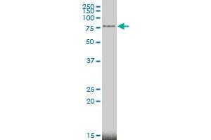 MECP2 monoclonal antibody (M01), clone 4B6 Western Blot analysis of MECP2 expression in MCF-7 . (MECP2 anticorps  (AA 81-170))