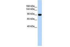 Image no. 1 for anti-Anoctamin 1, Calcium Activated Chloride Channel (ANO1) (AA 828-877) antibody (ABIN6740769) (ANO1 anticorps  (AA 828-877))