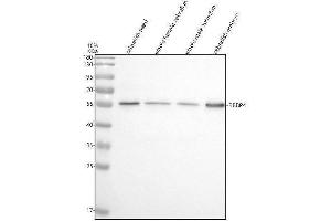 Western blot analysis of RBAP48/RBBP4 using anti-RBAP48/RBBP4 antibody (AZQ6P3H7).