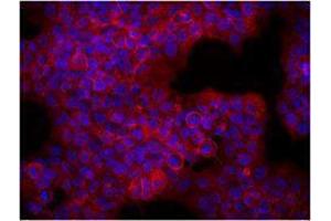 Immunofluorescence (IF) image for anti-Receptor tyrosine-protein kinase erbB-2 (ErbB2/Her2) antibody (ABIN2664603) (ErbB2/Her2 anticorps)