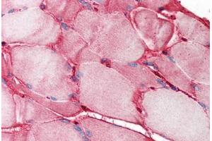 Human Skeletal Muscle (formalin-fixed, paraffin-embedded) stained with FN1 antibody ABIN214358 at 1. (Fibronectin 1 anticorps)