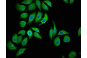 Immunofluorescence staining of A549 cells with ABIN7158336 at 1:100, counter-stained with DAPI.