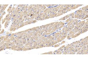 anti-Cardiac Troponin I (TNNI3) (AA 1-203) antibody