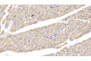 Detection of cTnI in Human Cardiac Muscle Tissue using Polyclonal Antibody to Cardiac Troponin I (cTnI) (TNNI3 anticorps  (AA 1-203))