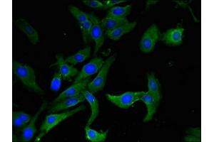 Immunofluorescent analysis of Hela cells using ABIN7144661 at dilution of 1:100 and Alexa Fluor 488-congugated AffiniPure Goat Anti-Rabbit IgG(H+L) (AHRR anticorps  (AA 255-506))