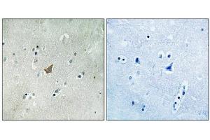 Immunohistochemical analysis of paraffin-embedded human brain tissue using EPHA3/4/5 (Phospho-Tyr779/833) antibody (left)or the same antibody preincubated with blocking peptide (right). (EPH Receptor A3 anticorps  (pTyr779, pTyr833))