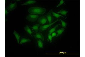 Immunofluorescence of monoclonal antibody to PBK on HeLa cell.