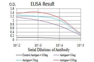 Black line: Control Antigen (100 ng),Purple line: Antigen (10 ng), Blue line: Antigen (50 ng), Red line:Antigen (100 ng)
