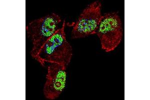Fluorescent confocal image of MDA-M cell stained with ZN Antibody (Center) (ABIN653731 and ABIN2843038).
