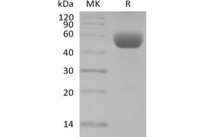Western Blotting (WB) image for CD79b Molecule, Immunoglobulin-Associated beta (CD79B) protein (Fc Tag) (ABIN7320886)