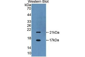 Figure. (CBY1/PGEA1 anticorps  (AA 7-127))