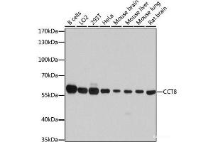 Western blot analysis of extracts of various cell lines using CCT8 Polyclonal Antibody at dilution of 1:7000. (CCT8 anticorps)
