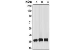 Western blot analysis of MART-1 expression in HeLa (A), A431 (B), WERI (C) whole cell lysates. (MLANA anticorps  (Center))
