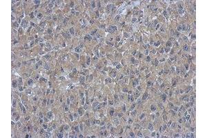 anti-Armadillo Repeat Containing 1 (ARMC1) (AA 1-235) antibody