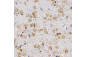 Immunohistochemistry of paraffin-embedded mouse brain tissue using H3K36me3 antibody at dilution of 1:200 (x400 lens).