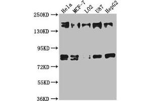 Western Blot Positive WB detected in: Hela whole cell lysate, MCF-7 whole cell lysate, L02 whole cell lysate, U87 whole cell lysate, HepG2 whole cell lysate All lanes: ZFYVE9 antibody at 1:1000 Secondary Goat polyclonal to rabbit IgG at 1/50000 dilution Predicted band size: 157, 151, 84 kDa Observed band size: 157 kDa