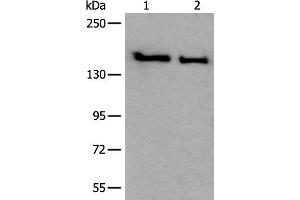Western blot analysis of HUVEC and Jurkat cell lysates using SMC1A Polyclonal Antibody at dilution of 1:300 (SMC1A anticorps)