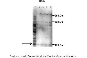 Lanes:   Lane1: 50 ug human placental tissue lysate Lane2: 40 ug human placental tissue lysate Lane3: 30 ug human placental tissue lysate Lane4: 20 ug human placental tissue lysate Lane5: 20 ug human myometrial tissue lysate  Primary Antibody Dilution:   1:500  Secondary Antibody:   Goat anti-rabbit HRP  Secondary Antibody Dilution:   1:10000  Gene Name:   Caveolin 3  Submitted by:   Hiten Mistry, Ania Czajka and Marta Hentschke Ribeiro, King's College London