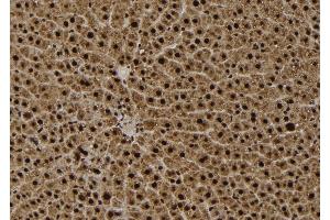 ABIN6279420 at 1/100 staining Rat liver tissue by IHC-P. (EIF2C3 anticorps  (Internal Region))