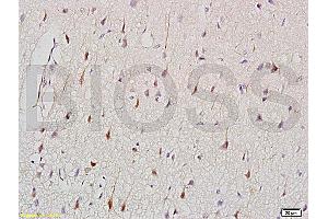 Formalin-fixed and paraffin embedded: rat brain tissue labeled with Anti-CK2 Polyclonal Antibody (ABIN730813), Unconjugated at 1:200, followed by conjugation to the secondary antibody and DAB staining