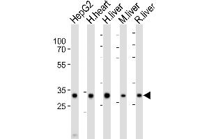 Western blot analysis of lysates from HepG2 cell line, human heart, human liver, mouse liver, rat liver tissue lysate (from left to right), using DECR1 Antibody (Center) (ABIN6243564 and ABIN6577825). (DECR1 anticorps  (AA 241-274))
