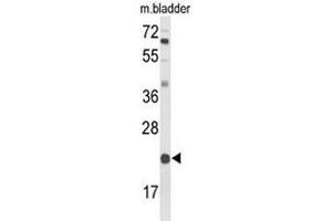 Western blot analysis of DGCR6 Antibody (Center) in mouse bladder tissue lysates (35µg/lane). (DGCR6 anticorps  (Middle Region))