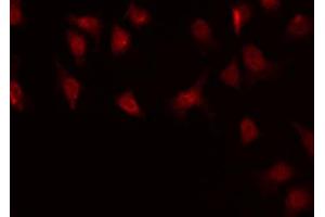 ABIN6268849 staining HuvEc by IF/ICC.