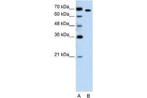 WB Suggested Anti-RORA Antibody Titration:  1. (RORA anticorps  (Middle Region))