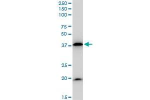 BAG1 monoclonal antibody (M02), clone 2D3.