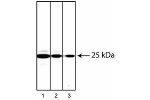 Western blot analysis of Rab27 in human chronic myelogenous leukemia. (RAB27A anticorps)