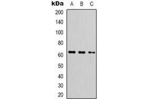 Western blot analysis of FUBP3 expression in HEK293T (A), HepG2 (B), MCF7 (C) whole cell lysates. (FUBP3 anticorps)