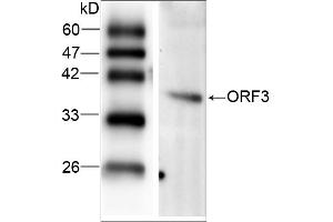 WB analysis of recombinant Hepatitis E virus ORF 3, using HEV ORF3 antibody. (HEV ORF3 anticorps  (AA 34-123))
