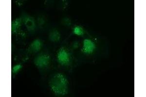 Anti-SPR mouse monoclonal antibody (ABIN2453684) immunofluorescent staining of COS7 cells transiently transfected by pCMV6-ENTRY SPR (RC205679). (SPR anticorps)