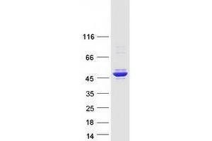 Validation with Western Blot