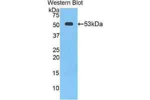 Western Blotting (WB) image for anti-Cathepsin K (CTSK) (AA 90-318) antibody (ABIN1858554)