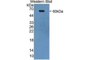 Detection of Recombinant EPHA4, Human using Polyclonal Antibody to Ephrin Type A Receptor 4 (EPHA4)